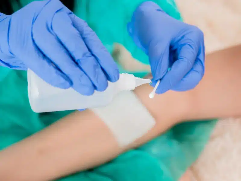 wound care